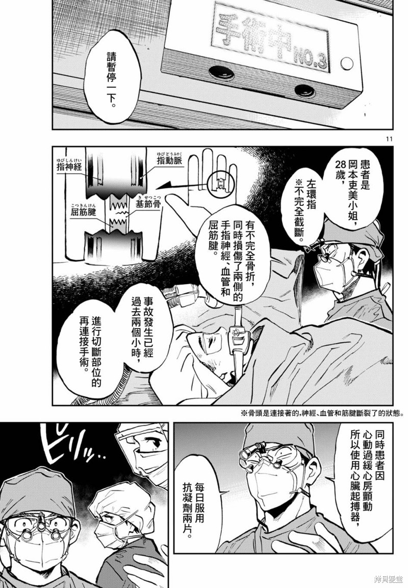 手外科漫画,第6话11图