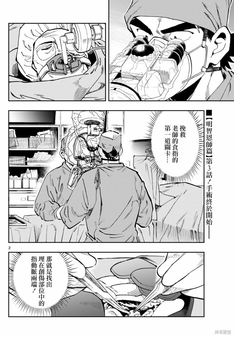 手外科漫画,第28话2图