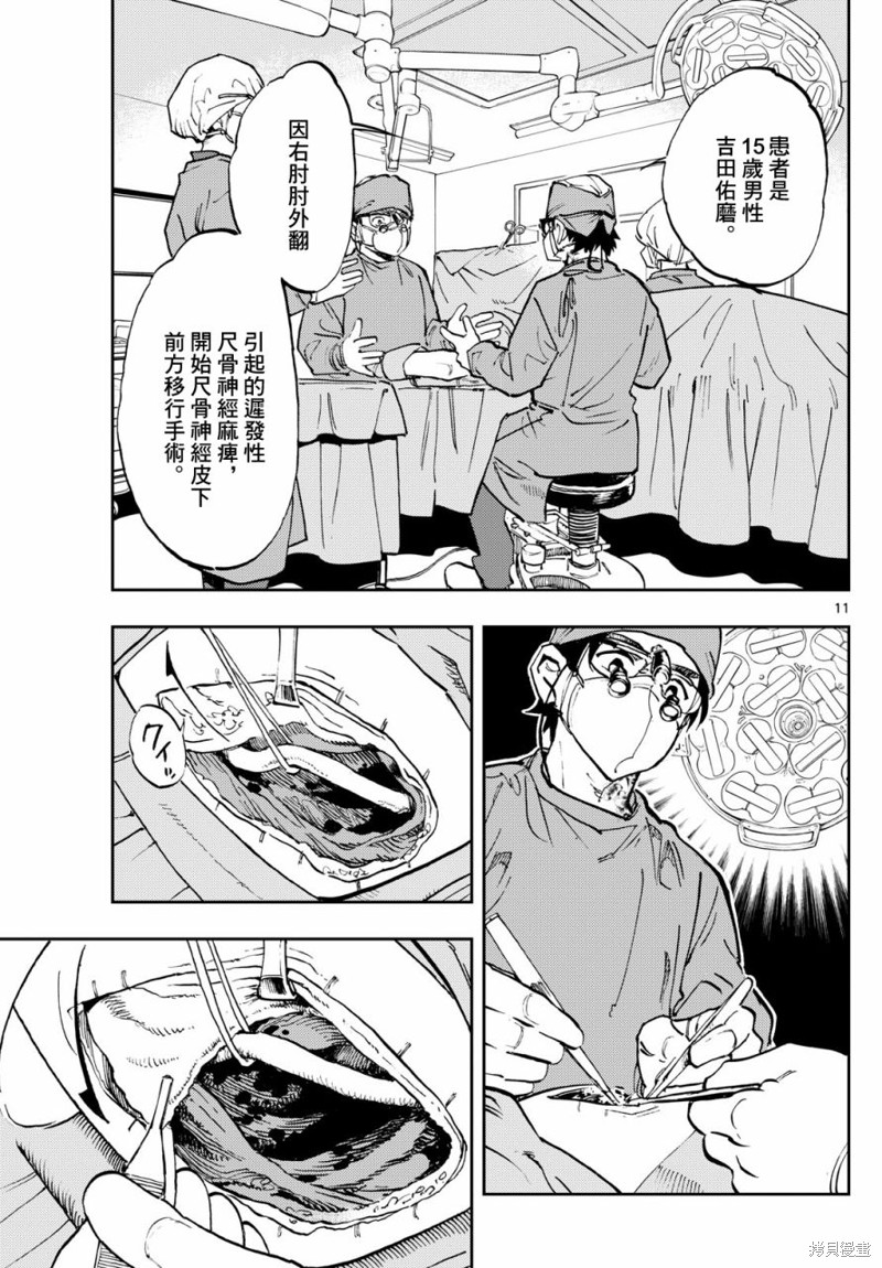 手外科漫画,第3话11图